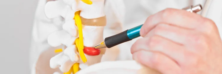 Troy MO Chiropractor Discusses Herniated Discs